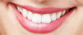 Gesundheitstipp - "Schöne Zähne, ein schönes Lächeln"